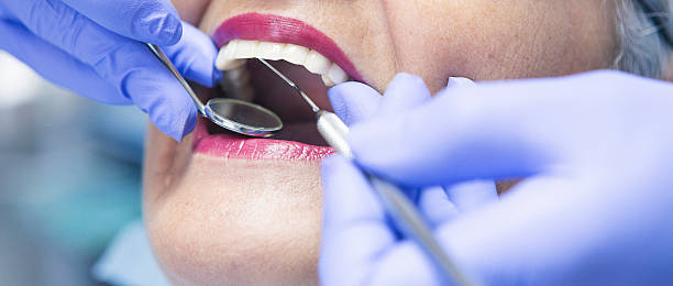 Best Dental Abscess Treatment in Thornton, CO